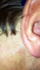 Un truc dans l'oreille