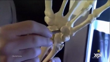 CORAZÓN ROTO DE JESÚS