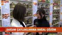 Doğum çatlaklarına doğal çözüm atv Ana Haber