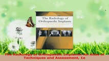 Read  The Radiology of Orthopaedic Implants An Atlas of Techniques and Assessment 1e Ebook Free