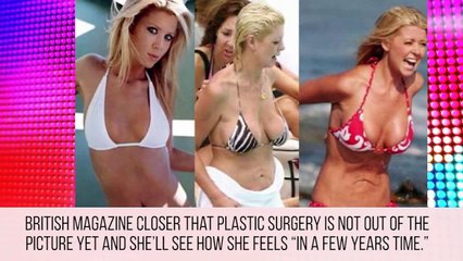 The Biggest Celebrity Plastic Surgery Fails