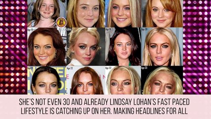 Celebrities Who Have Aged Horribly