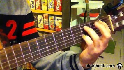 Candan Erçetin - Onlar Yanlış Biliyor