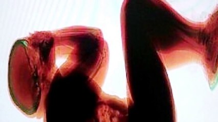 5 People Who Slept at the Worst Possible Time