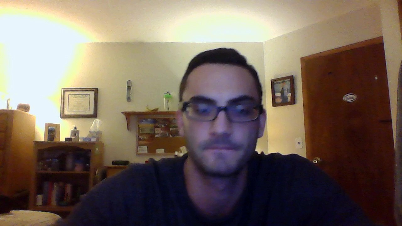 Shin Splints - Causes, Treatment, Prevention