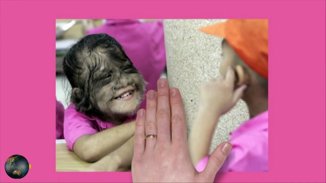 5 People with Body Oddities PakTube