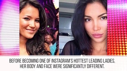 10 Hot Instagram Stars Before Plastic Surgery