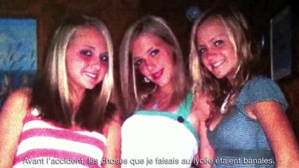 Cette jeune femme a été défigurée à cause d'un geste que trop de gens font encore.