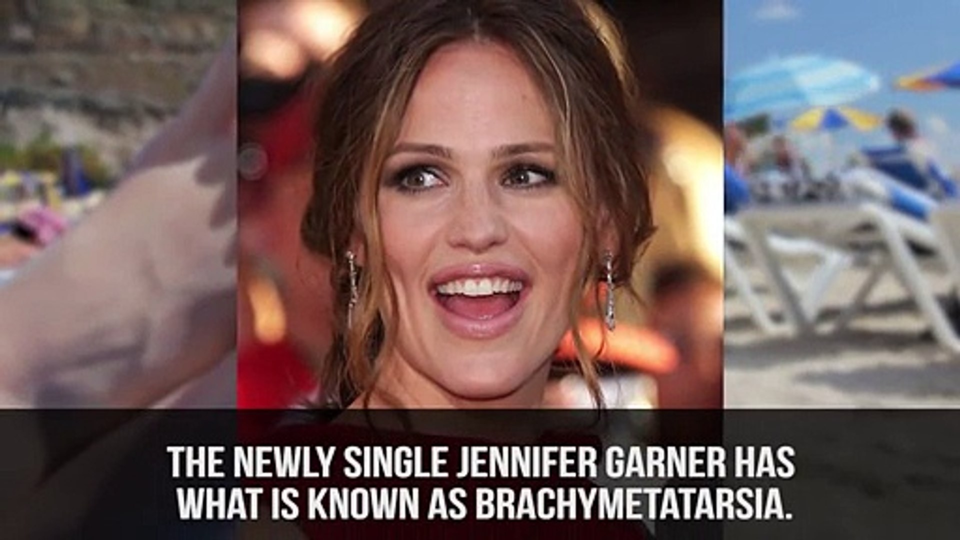 ⁣10 Celebrities With Physical Deformities