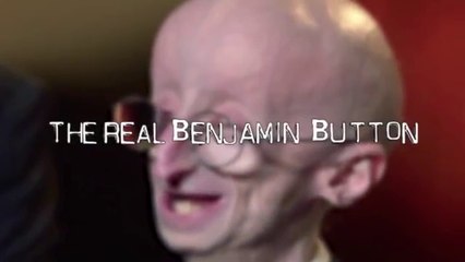 People with the Strangest Medical Conditions