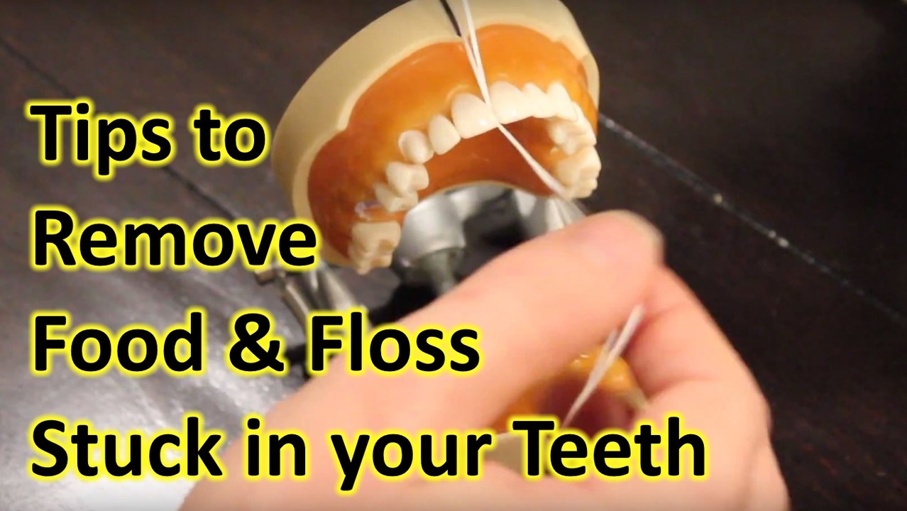 How to Remove Food Stuck in Teeth & Floss Stuck Between Teeth. My Teeth Pain Care