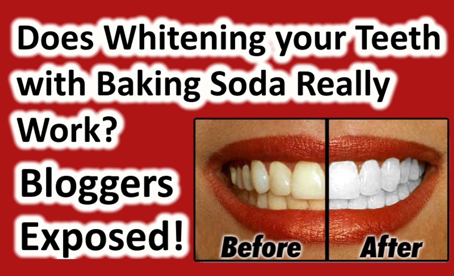 Can I whiten my teeth at home with Baking Soda: Debunked! Does DIY whitening  work? - video Dailymotion