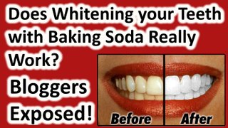 Can I whiten my teeth at home with Baking Soda: Debunked! Does DIY whitening work?