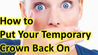 How to recement a Temporary Crown. Temporary crown fell off Temporary crown fell out.