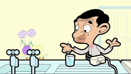 Mr Bean Broken Tooth Wackelzahn