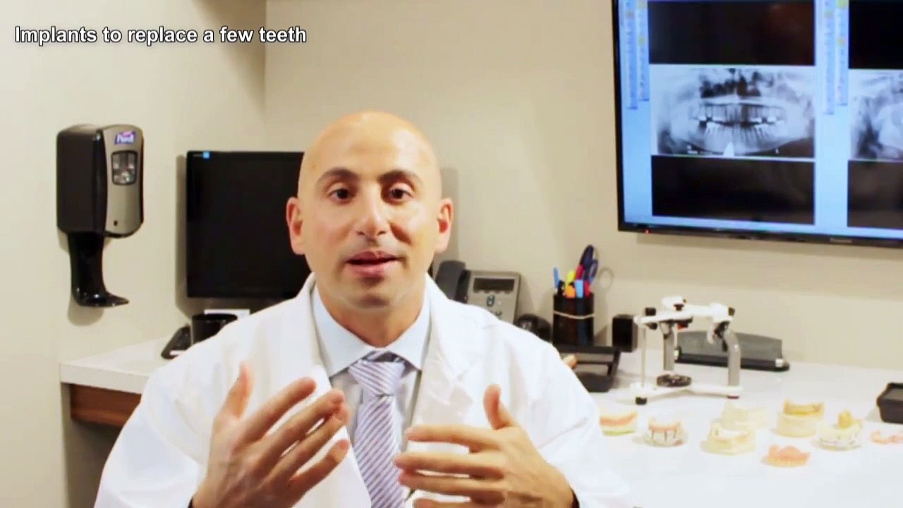 Implants to replace a few teeth - Daniel Daniel Dentistry