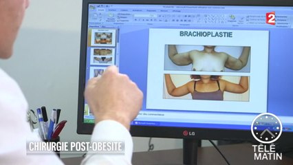 Santé - Le boom des body lifts - 2015/01/04