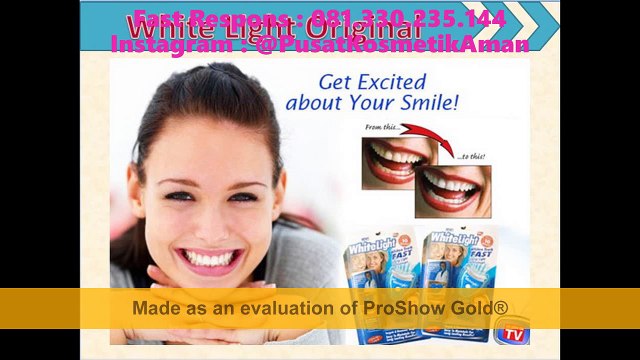 Pemutih Gigi Yang Aman, Pemutih Gigi Yang Murah, Pemutih Gigi Yng Paling Bagus, 081.330.235.144