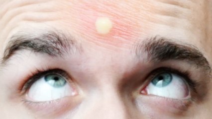 SQUEEZIE-APPUIEREZ-VOUS SUR LE BOUTON  #2