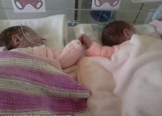 Bliznakinje prekrasan trenutak