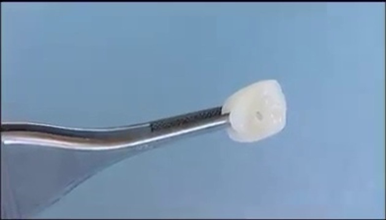 Teeth Implant prototype dailymotion