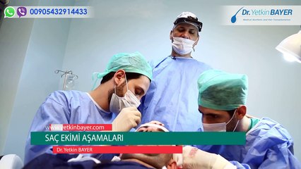 Dr. Yetkin Bayer - Saç ekim aşamaları