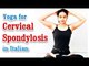 Yoga for Cervical Spondylosis - Natural Methods to Cure Neck and Shoulder Pain in Italian