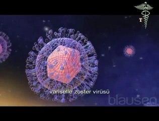 Su Çiçeği Nasıl Bir Hastalıktır ?