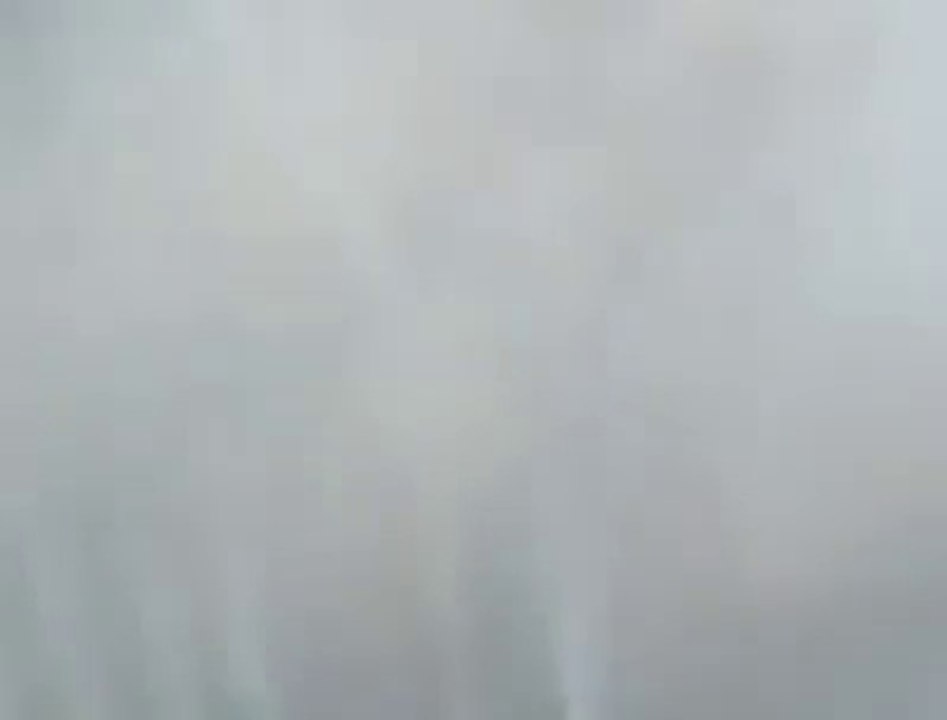 Удаляем угри на лице. Слабонервным не смотреть. acne on the face