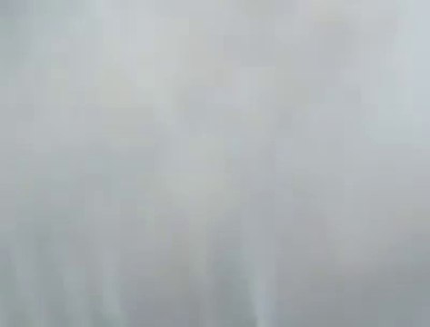 Удаляем угри на лице. Слабонервным не смотреть. acne on the face