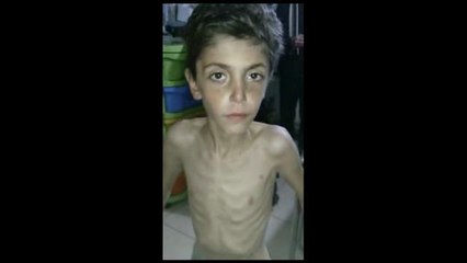 La gente se está muriendo de hambre en Madaya_