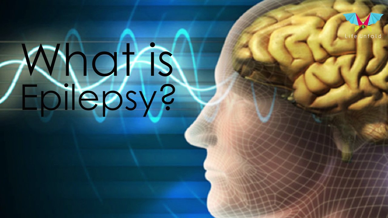 All About Epilepsy
