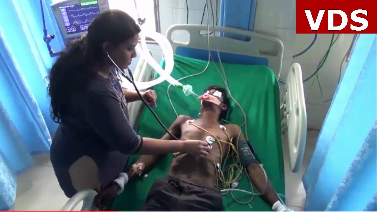 Man needed 4 hour operation after swallowing foot long set of iron tongs for bet