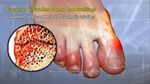 Swollen Toe: Treatment, Causes, Symptoms