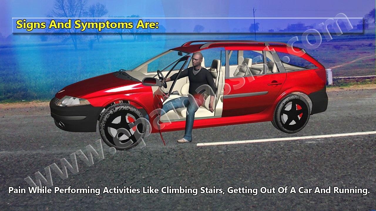 Hip Bursitis or Trochanteric Bursitis 3D Video: Watch How it is Caused, Know Its Treatment, PT, Symptoms