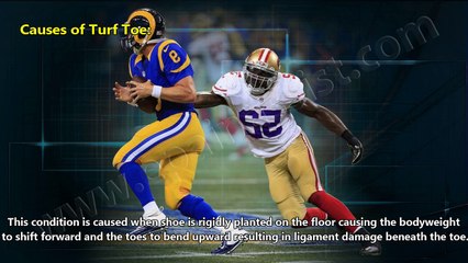Turf Toe: Causes, Symptoms, Treatment