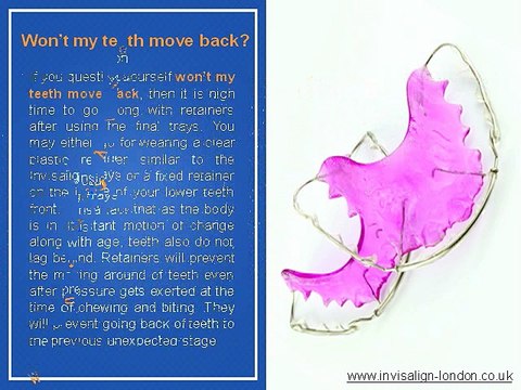 Invisalign London - Your Guide to Invisible Braces