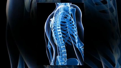 Best Thoracic Surgeons Plano TX: Get Your Fractures Fixed Quickly