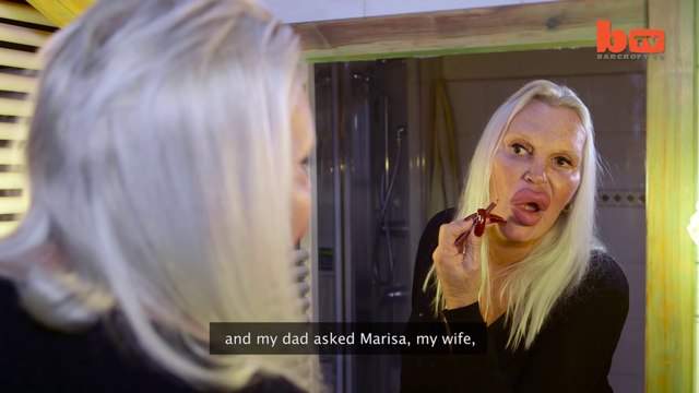 Obsessive Trans Woman spent $76000 in Plastic Surgery