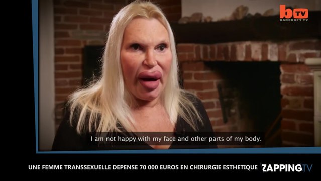 Une femme transsexuelle en quête du corps parfait dépense plus de 70 000 euros en chirurgie esthétique