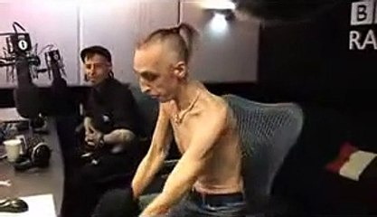 L'homme elastique , il fait des trucs pas possible avec la peau de son corp