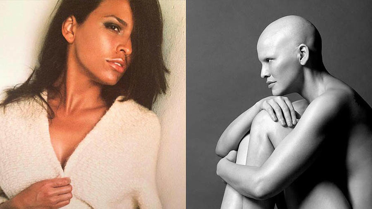 Model With Breast Cancer's Stunning, Raw Photos Reveal "What Cancer Looks Like"