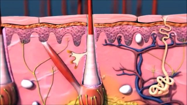 Blackhead Hypothesis; Does Darker Skin Produce More Black Heads