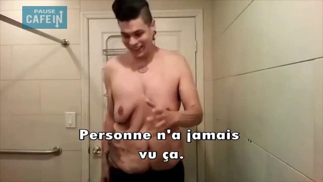 Il perd plus de 135 kilos, il ose enfin montrer son corps et les ravages de l'obésité