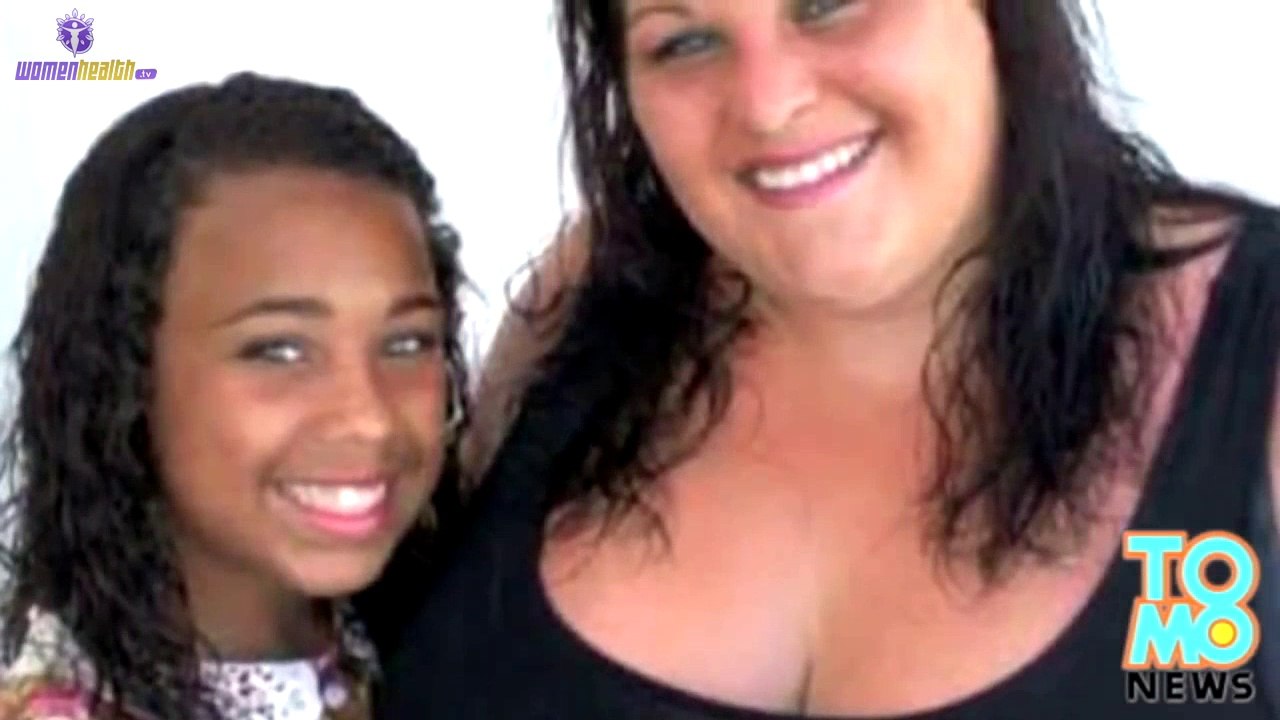 Woman with huge 38KK breasts refused breast reduction surgery by UK healthcare NHS