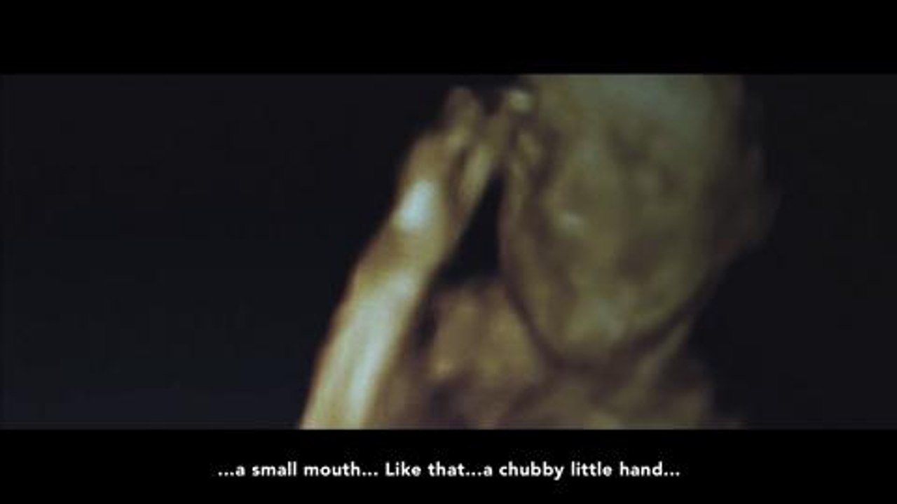 Una embarazada ciega ve a su hijo gracias a la impresión 3D