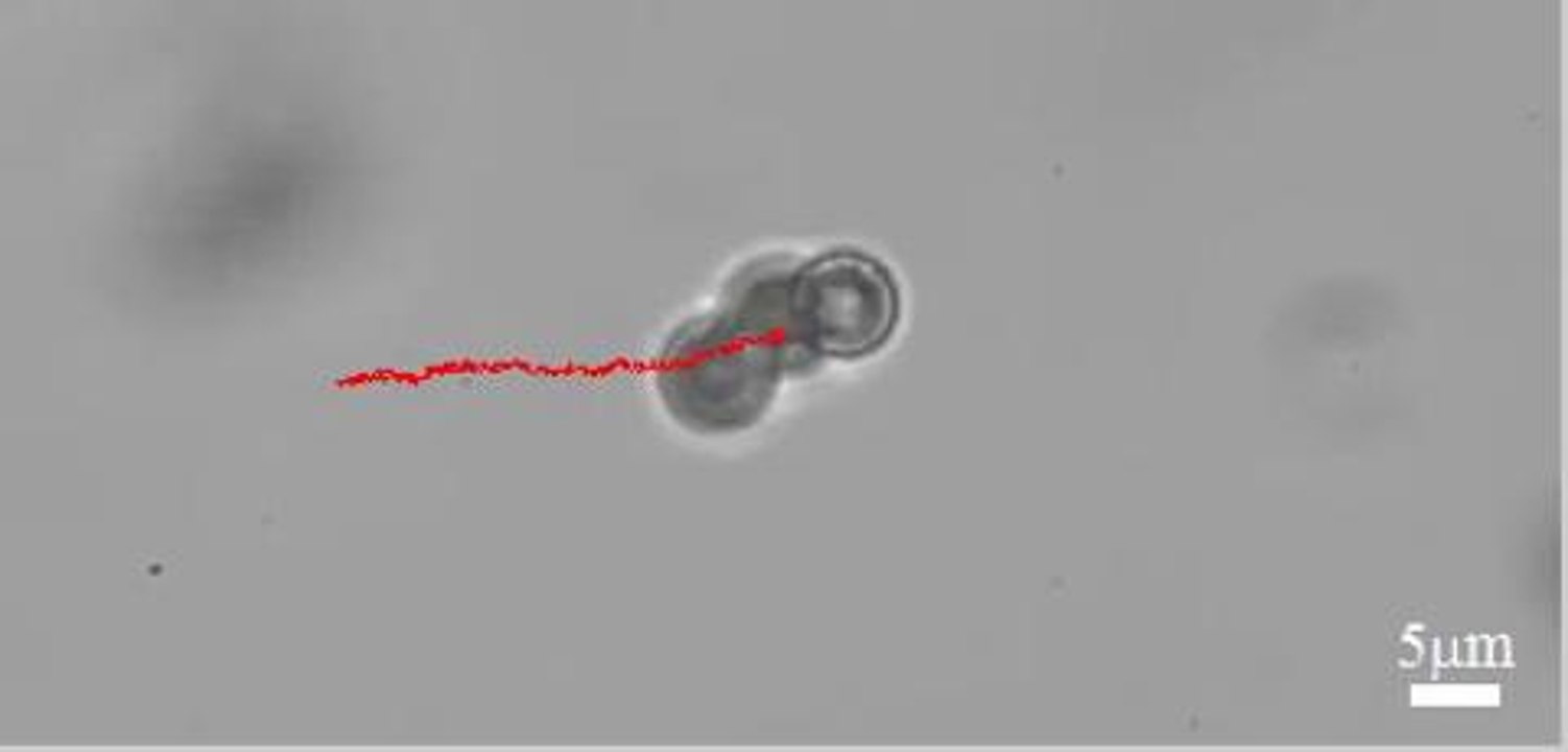 Demostración del funcionamiento de los micro-robots que limpian las arterias obstruidas