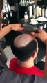 Hair Home İzmir Protez Saç Nasıl Uygulanır