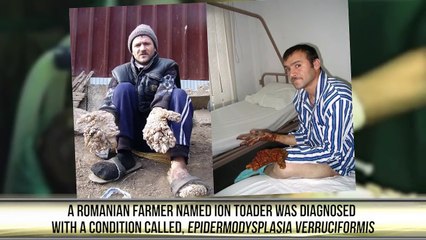 People with the Strangest Medical Conditions