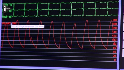 Descargar video: Accident lors d'un essai clinique à Rennes: quel était le protocole du test?